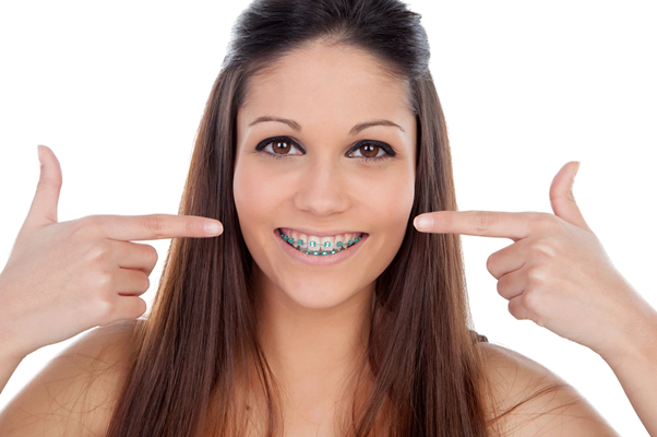 Teenager wearing braces without stained teeth